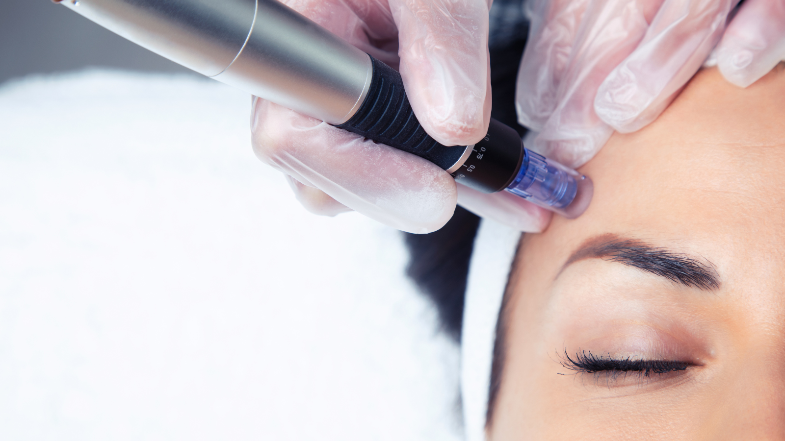 The Benefits of Microneedling at The Laser Lounge Spa Cape Coral